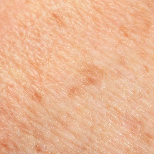 Anti-âge