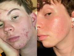 Zero Pore Pad 2.0 MEDICUBE — texture pad exfoliant doux