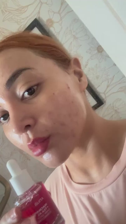 Niacinamide 10% + TXA 4% Serum